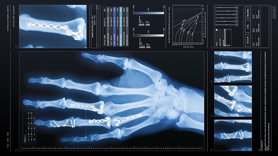 Video X-ray service
